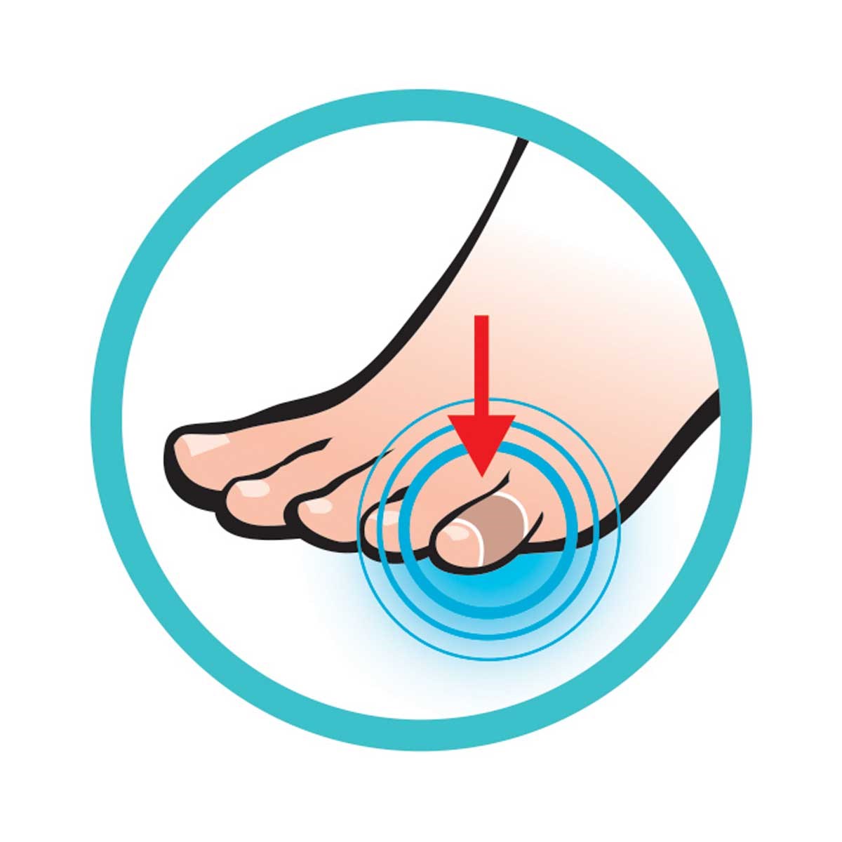 Chránič pokožky Sidas On Skin Toe Protector (5 ks) Sidas 10000923 L-11