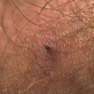 Karta Lifesystems Tick Remover Card